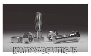 نصب نمای سنگی با پیچ و مهره