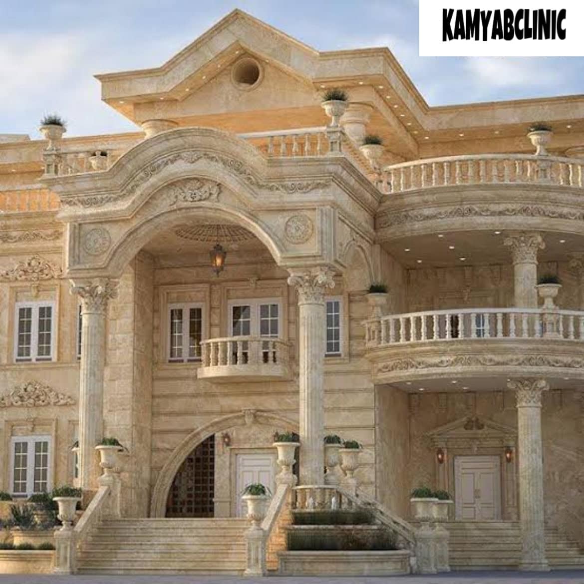 نمای سنگی با چسب‌های اپوکسی